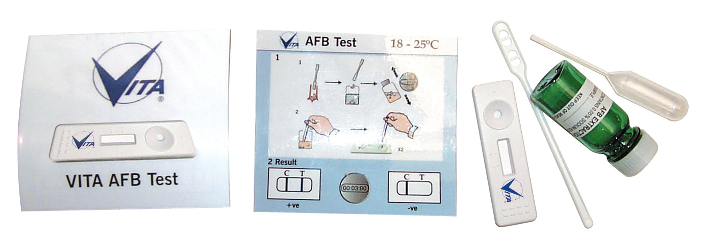 AFB test